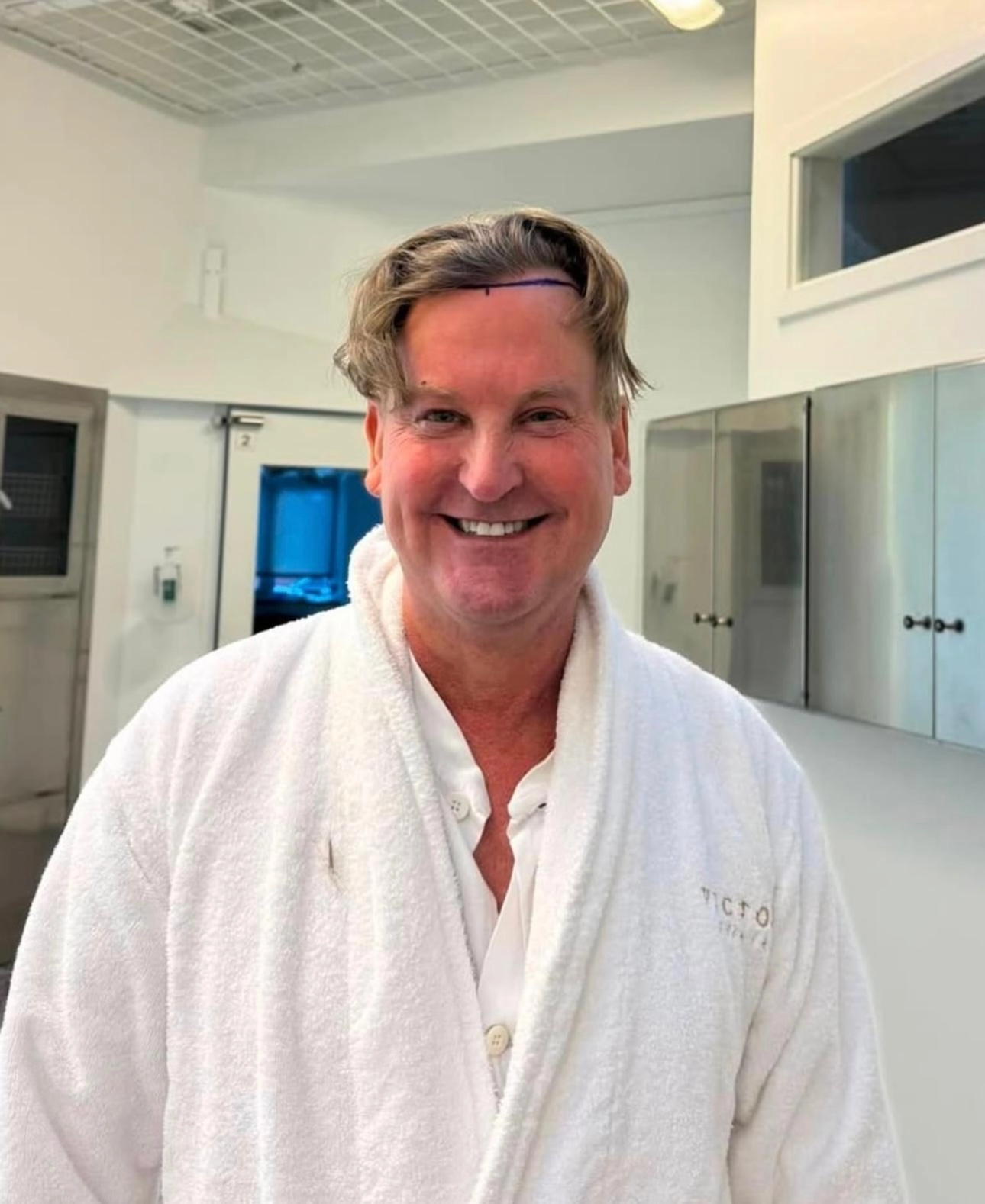 DHI hårtransplantation 