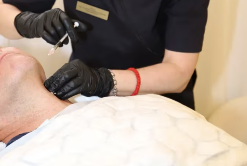 PRP för skägg